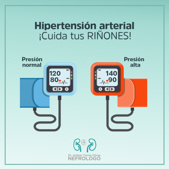 Hipertensión Arterial